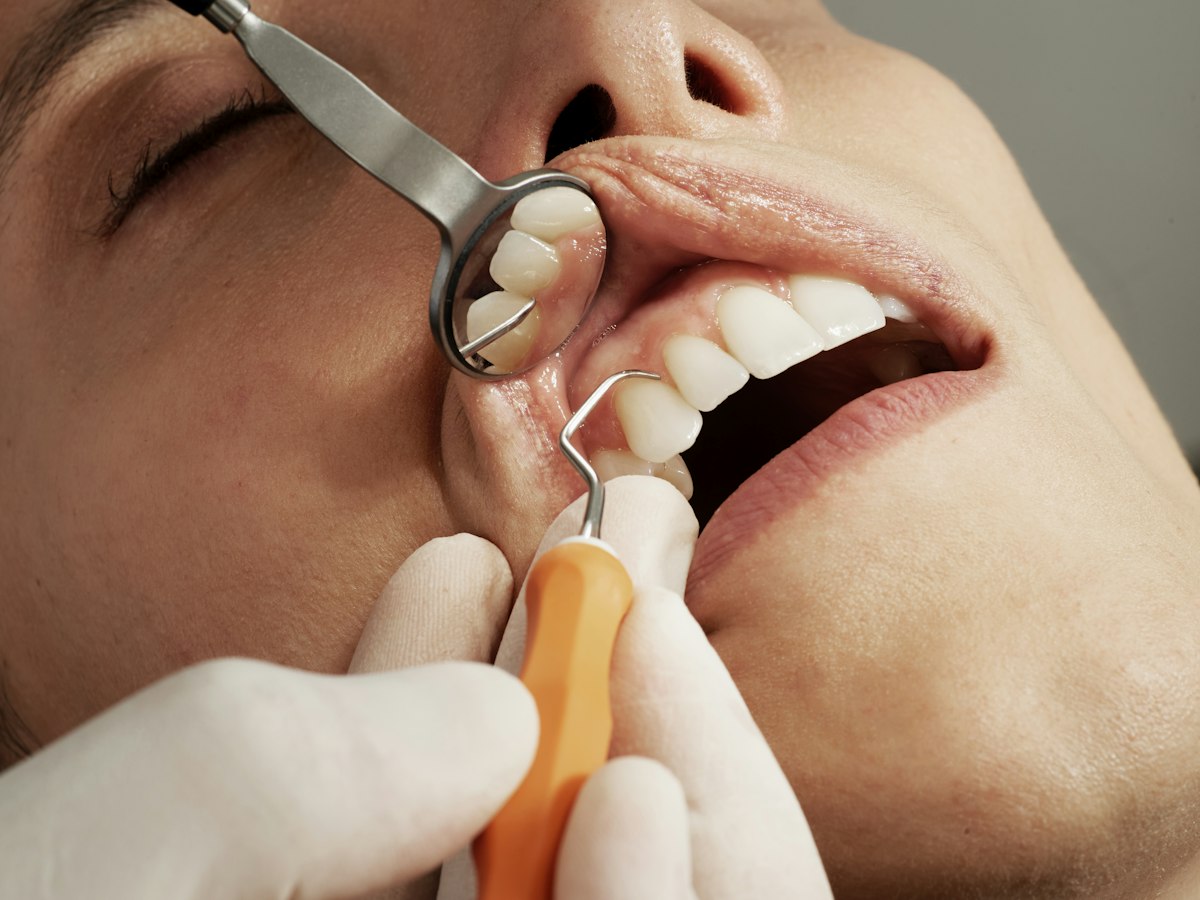 A dental mirror and probe held at a patient's teeth