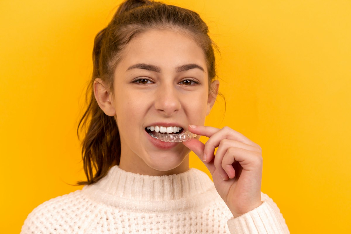 A girl fitting a clear aligner